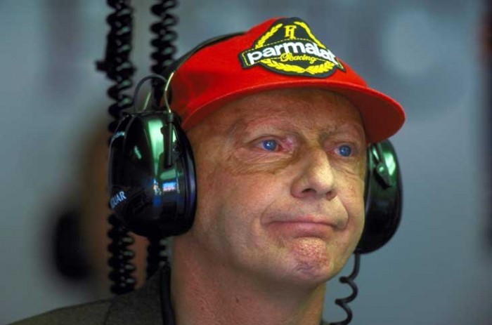 Lekerül Laudáról a Parmalat sapka?