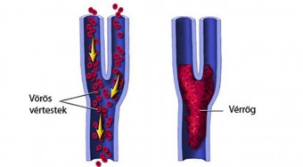Belehalhatunk a hosszú utazásba