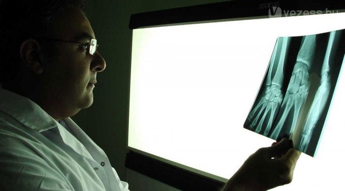 Ez sajkacsont törés lesz