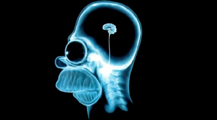 Túl sokat volt vidéken, nem fejlődött ki az agya