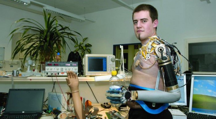 Jogsi a robotkarú embernek 4