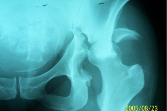 Mi történik az emberi testtel autóbalesetben?