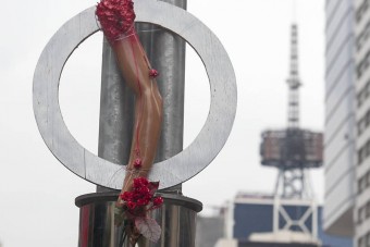 Letépte a biciklis karját az autó