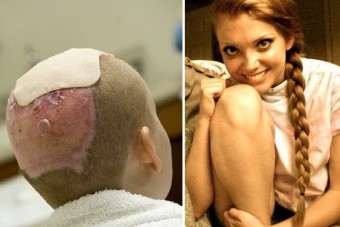 Megskalpolta a gokart a hosszú hajú lányt