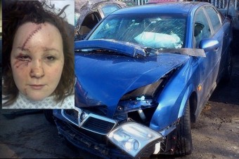 Kettészakadt a menyasszony arca a balesetben