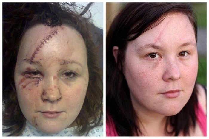 Kettészakadt a menyasszony arca a balesetben 7 | Vezess Kettészakadt a menyasszony arca a balesetben 7