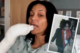 Beparkolt a helyükre, leharapták az ujját