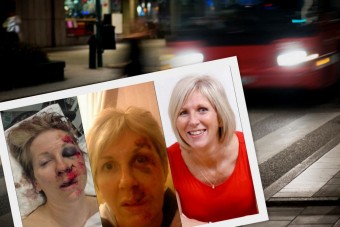 Megsemmisült az arca, modellnek állt