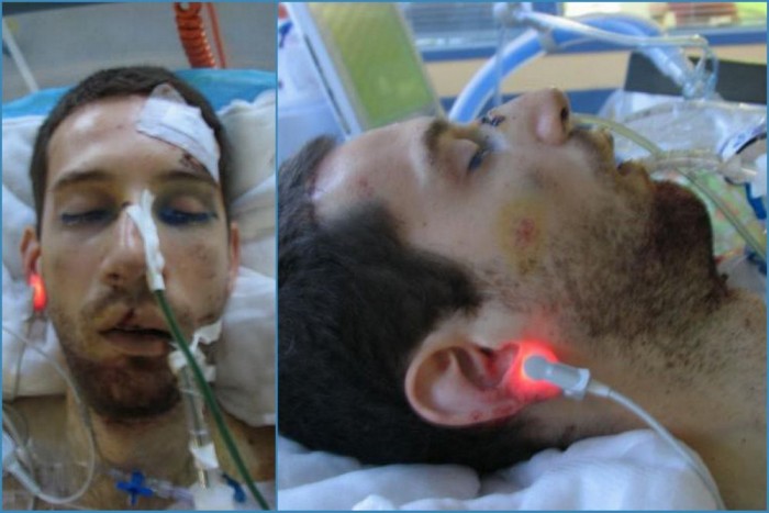 Kutyának hitte magát, autókat kergetett 3 | Vezess Kutyának hitte magát, autókat kergetett 3