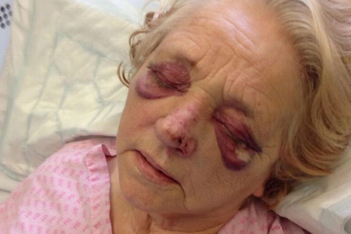 Másfél órát várt a mentőre az elgázolt nagymama 6 | Vezess Másfél órát várt a mentőre az elgázolt nagymama 6