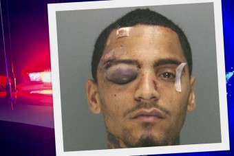 Elgázoltak, félholtra vertek egy férfit a rendőrök