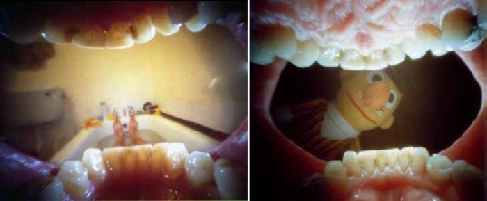 Vannak, akik a szájukból is kifotóznak. Justin Quinnell az elkövető