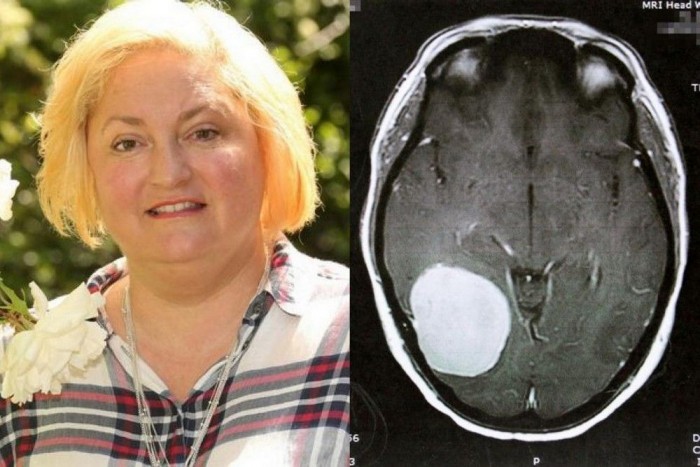 Majdnem meghalt, ez mentette meg az életét 3