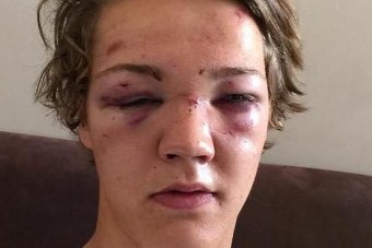 Péppé verték a tinit egy koccanás miatt