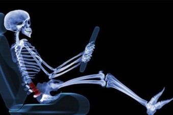 Ez történik a testeddel egy baleset során