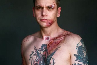 Kőkemény nyomot hagy a biztonsági öv, cserébe megmenti az életed