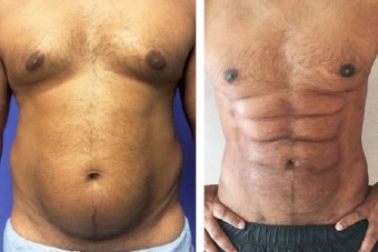 Így lehet a lustáknak kockahasuk