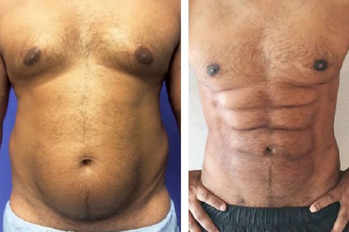 Így lehet a lustáknak kockahasuk