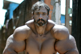 Ilyen furcsa habtest a jutalma annak, aki súlyok helyett injekciókkal edz