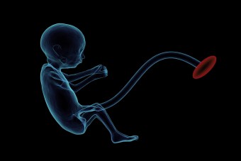 Minden ember gyíkizmokkal kezdi az életet