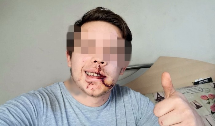 Elég kemény fotóval üzent a 86-os főúton történt baleset vétlen sofőrje 1