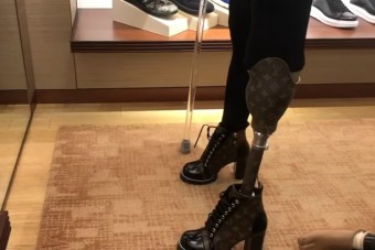 Luxustáskából csináltatott magának protézist a lábát elveszítő modell