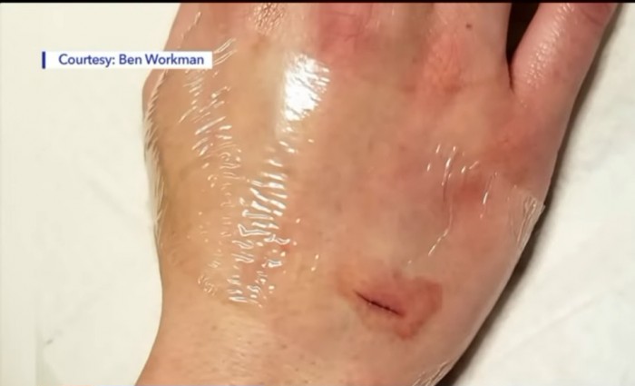 Bőre alá ültette a kocsikulcsot egy férfi 2 | Vezess Bőre alá ültette a kocsikulcsot egy férfi 2