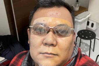 Itt tart a tudomány: kinyomtathatod otthon a saját arcod