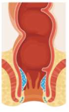 Miért kell gyorsan cselekedned, ha aranyered van? Képeken mutatjuk a választ (x) 1