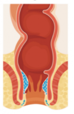 Miért kell gyorsan cselekedned, ha aranyered van? Képeken mutatjuk a választ (x) 2