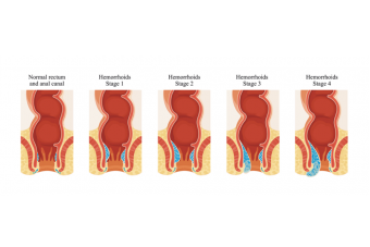 Miért kell gyorsan cselekedned, ha aranyered van? Képeken mutatjuk a választ (x)