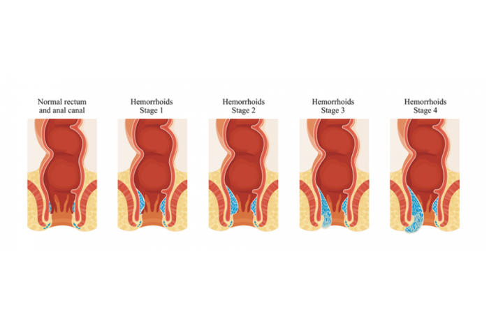 Miért kell gyorsan cselekedned, ha aranyered van? Képeken mutatjuk a választ (x)