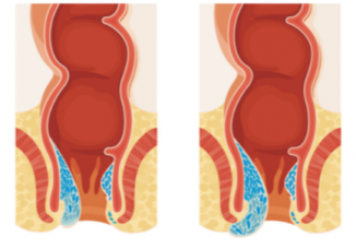 Miért kell gyorsan cselekedned, ha aranyered van? Képeken mutatjuk a választ (x) 3