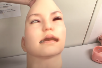 Ennél a megvadult fogászati robotnál nem látsz ma furcsábbat