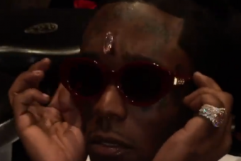 Hétmilliárdot érő gyémántot műtöttek rá az amerikai rapper homlokára