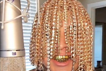 Aranyláncokat ültetett haja helyére a rapper