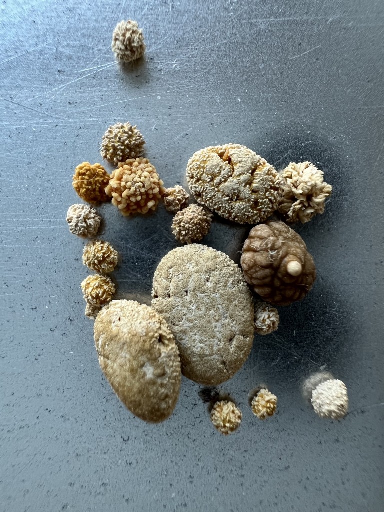 Saját veseköveit árulja a filmrendező 2