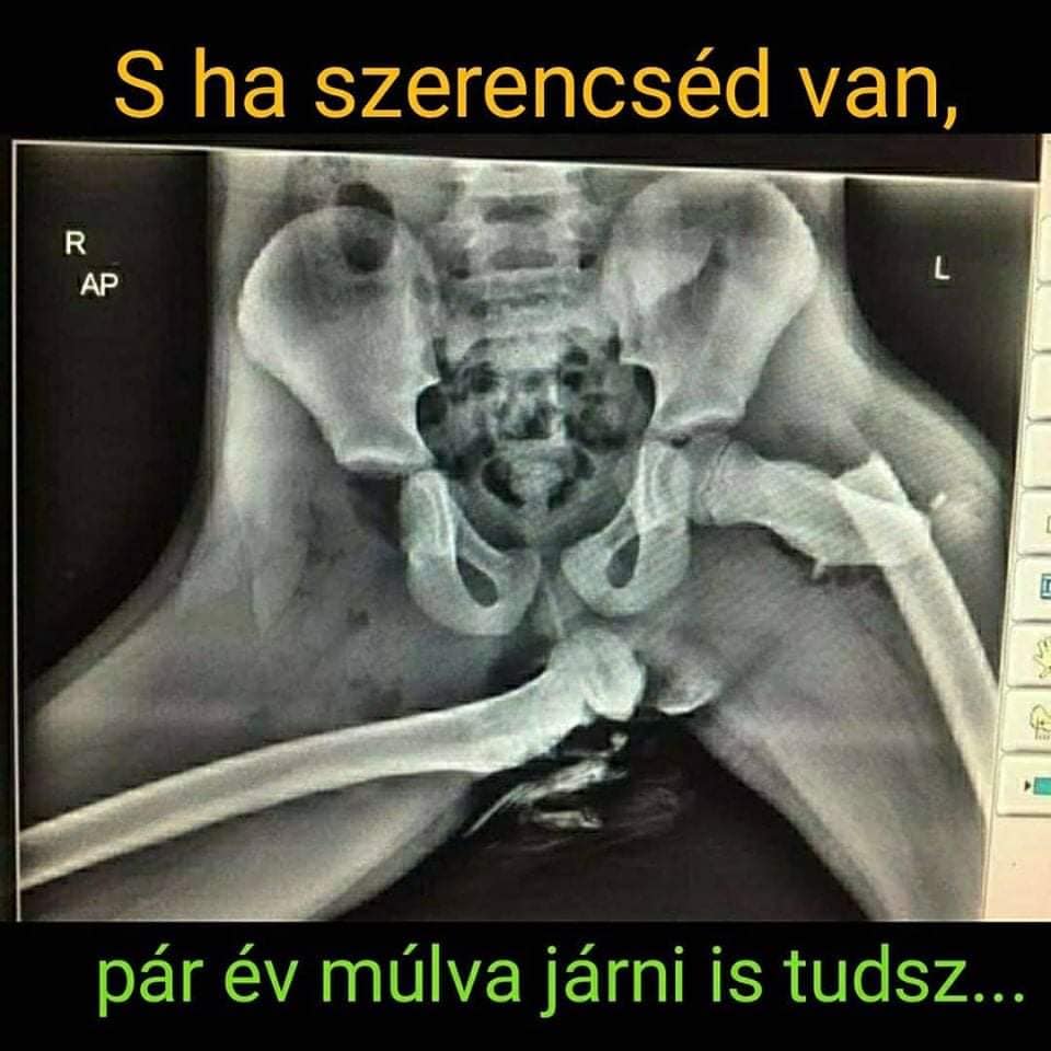 Ez a 6 kép keményen mutatja, mekkora őrültség így utazni az autóban 5