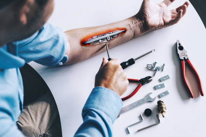 Egy férfi beépíttette a kezébe autója kulcsát