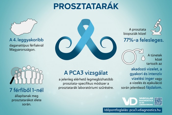 Prosztatarákszűrés vizeletből, fájdalommentesen a Vascular Diagnostics laboratóriumában! (x) 2