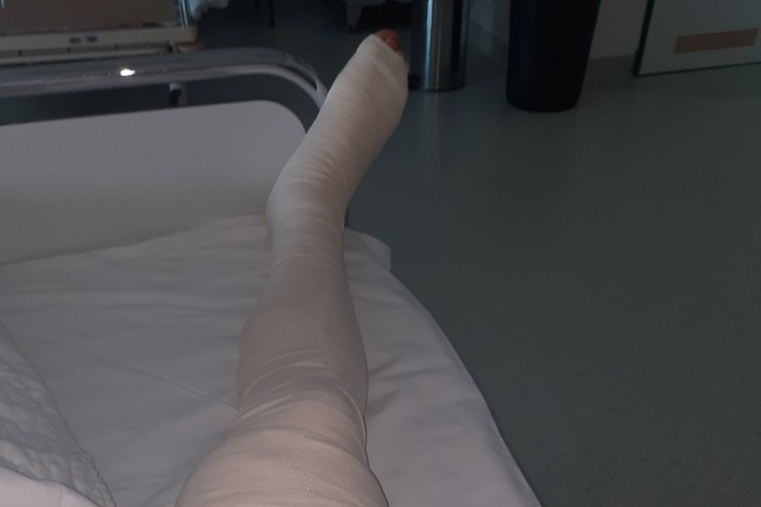 “Tiszta erőmből szorítottam a kormányt és ordítottam” – Szilárd lába vezetés közben égett meg 4 | Vezess “Tiszta erőmből szorítottam a kormányt és ordítottam” – Szilárd lába vezetés közben égett meg 4