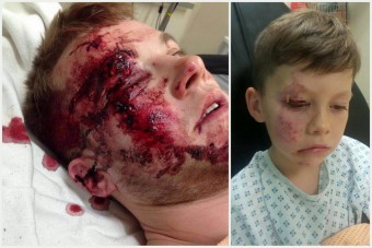 A kocsi elé dobta magát, hogy mentse unokaöccsét